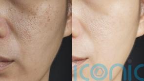 How to revive your skin post holiday indulgence