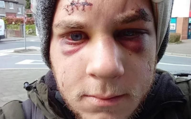 UPDATE: Fundraiser launched for Croatian man left with brain bleed after friend killed in Dublin assault