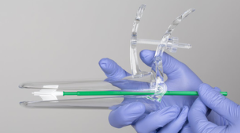 OPINION: I put off my cervical check but it wasn’t as bad as I thought it would be…